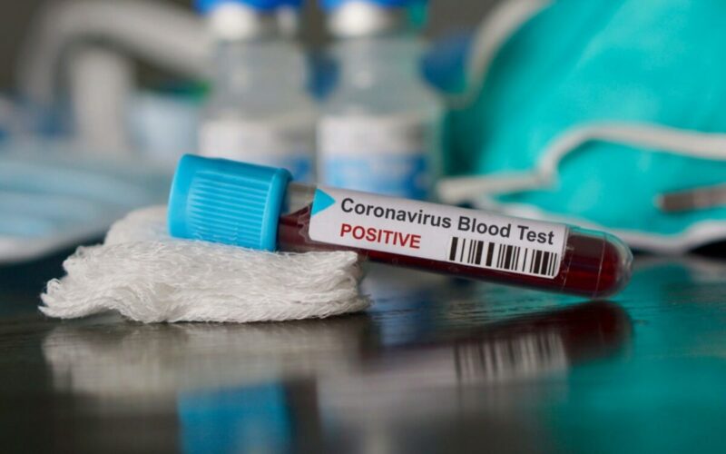 coronavirus morti