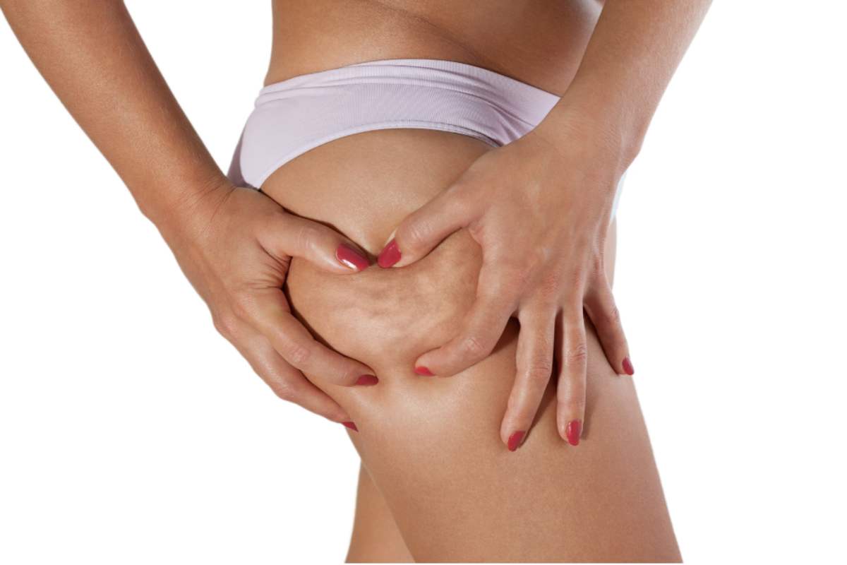 cellulite:-e-questo-lintegratore-naturale-che-aiuta-a-combatterla,-nessuno-lo-conosce