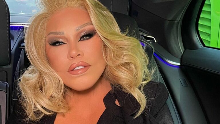 morta-la-donna-gatto,-jocelyn-wildenstein-aveva-84-anni:-lannuncio-del-compagno