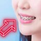 apparecchio-denti,-cosa-fare-se-si-stacca-una-piastrina-o-bracket:-niente-panico,-ecco-le-dritte